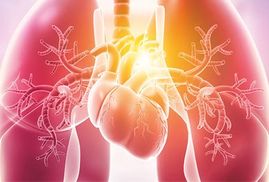 Aktuelle leitliniengerechte Therapie der pulmonal arteriellen Hypertonie