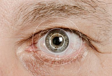 Diagnose der geografischen Atrophie – ein Update