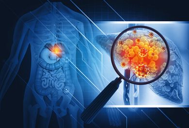 Fettlebererkrankungen richtig diagnostizieren